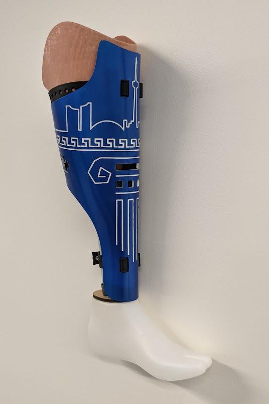 A prosthetic leg with a customized, blue design over it and designed by Alexander Toufexis